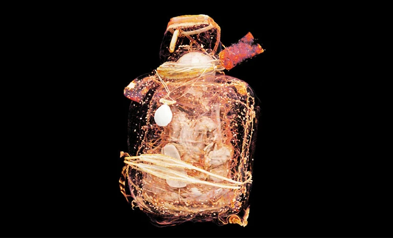 Múmias antigas, Descoberta arqueológica, Projeto Múmia Alemã, Técnicas de mumificação, Segredos da vida revelados, Causas de morte antigas, Evolução da análise científica, História das múmias, 'Mulher com as pernas cruzadas', Métodos de preservação, Restos mortais antigos, Ciência e múmias, Mistérios do passado, Análise de tecidos antigos, História da mumificação, Significado das múmias, Estudo forense de múmias, Tecnologias de análise em arqueologia, Descobertas de museus, Culturas funerárias antigas.