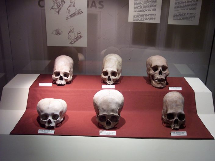 Crânios alongados de Paracas, Evidências de uma espécie humana perdida, Arqueologia peruana, Prática de deformação craniana, Origens genéticas dos Paracas, DNA antigo de crânios, Cultura pré-incaica, Antropologia forense, Mistérios da história humana, Povo Paracas, Pesquisas arqueológicas em Paracas, Legado dos povos antigos do Peru, Análise de DNA em crânios, Significado cultural dos crânios alongados, Práticas funerárias pré-colombianas, Interpretações arqueológicas controversas, Influência das antigas civilizações na América do Sul, Contexto histórico de Paracas, Ligações entre Paracas e outras culturas antigas, Crânios alongados e suas implicações na história mundial
