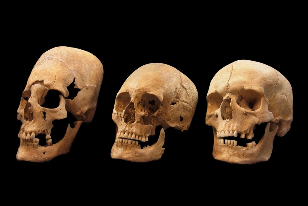 Crânios alongados de Paracas, Evidências de uma espécie humana perdida, Arqueologia peruana, Prática de deformação craniana, Origens genéticas dos Paracas, DNA antigo de crânios, Cultura pré-incaica, Antropologia forense, Mistérios da história humana, Povo Paracas, Pesquisas arqueológicas em Paracas, Legado dos povos antigos do Peru, Análise de DNA em crânios, Significado cultural dos crânios alongados, Práticas funerárias pré-colombianas, Interpretações arqueológicas controversas, Influência das antigas civilizações na América do Sul, Contexto histórico de Paracas, Ligações entre Paracas e outras culturas antigas, Crânios alongados e suas implicações na história mundial
