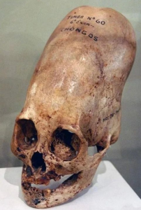 Crânios alongados de Paracas, Evidências de uma espécie humana perdida, Arqueologia peruana, Prática de deformação craniana, Origens genéticas dos Paracas, DNA antigo de crânios, Cultura pré-incaica, Antropologia forense, Mistérios da história humana, Povo Paracas, Pesquisas arqueológicas em Paracas, Legado dos povos antigos do Peru, Análise de DNA em crânios, Significado cultural dos crânios alongados, Práticas funerárias pré-colombianas, Interpretações arqueológicas controversas, Influência das antigas civilizações na América do Sul, Contexto histórico de Paracas, Ligações entre Paracas e outras culturas antigas, Crânios alongados e suas implicações na história mundial